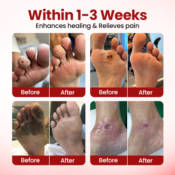 Timilk® VitaGluco Diabetic Care Cream ❤️