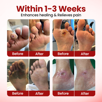 Timilk® VitaGluco Diabetic Care Cream ❤️