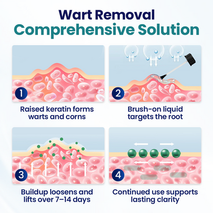 Timilk® WartLift Corn Removal Liquid ❤️