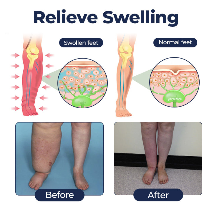 Timilk® SwellRelief Circulation Support Cream❤️