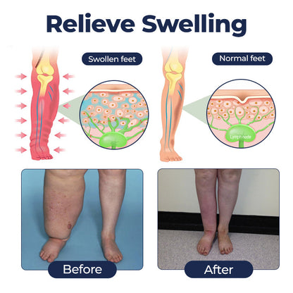 Timilk® SwellRelief Circulation Support Cream❤️