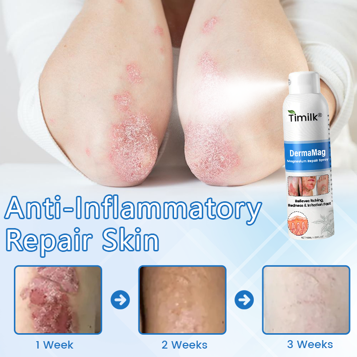 Timilk® DermaMag Magnesium Repair Spray ❤️
