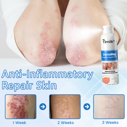 Timilk® DermaMag Magnesium Repair Spray ❤️