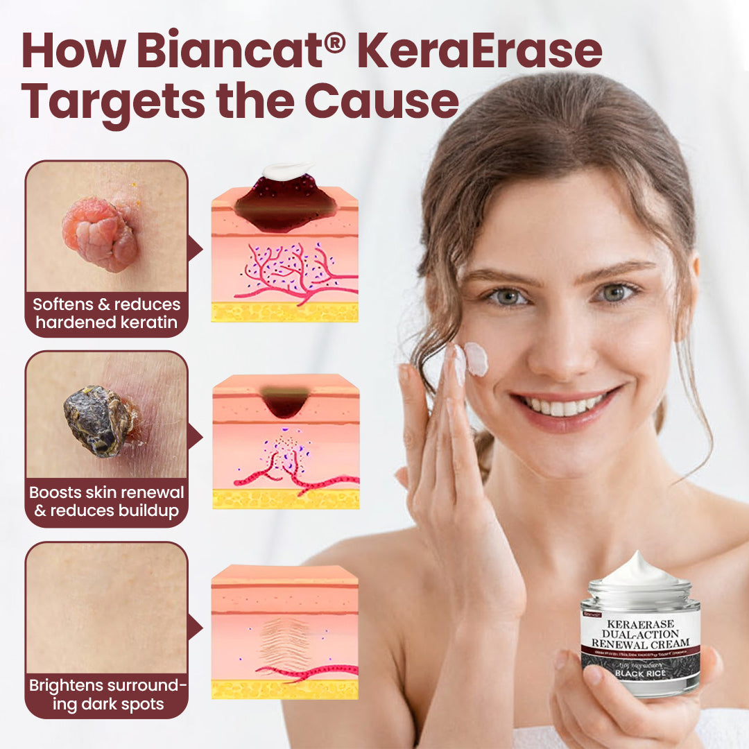 Biancat®KeraErase Dual-Action Renewal Cream❤️