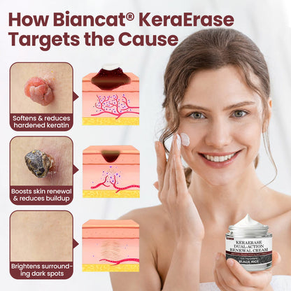 Biancat®KeraErase Dual-Action Renewal Cream❤️