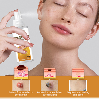 Timilk® BeeVenom Wart Renewal Spray