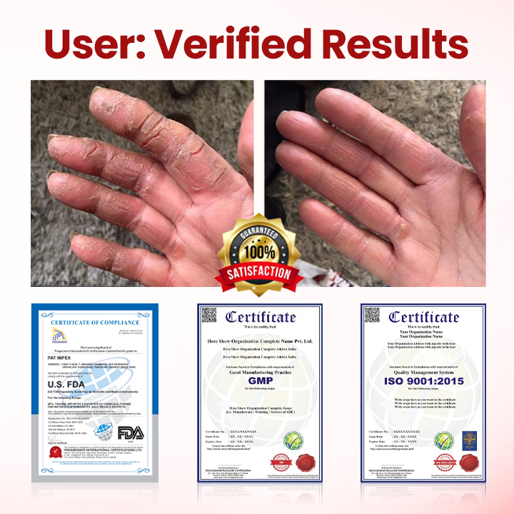 Timilk® VitaGluco Diabetic Care Cream ❤️