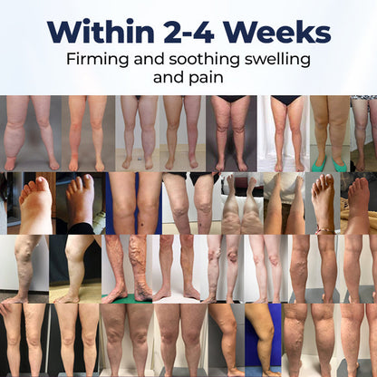 Timilk® SwellRelief Circulation Support Cream❤️