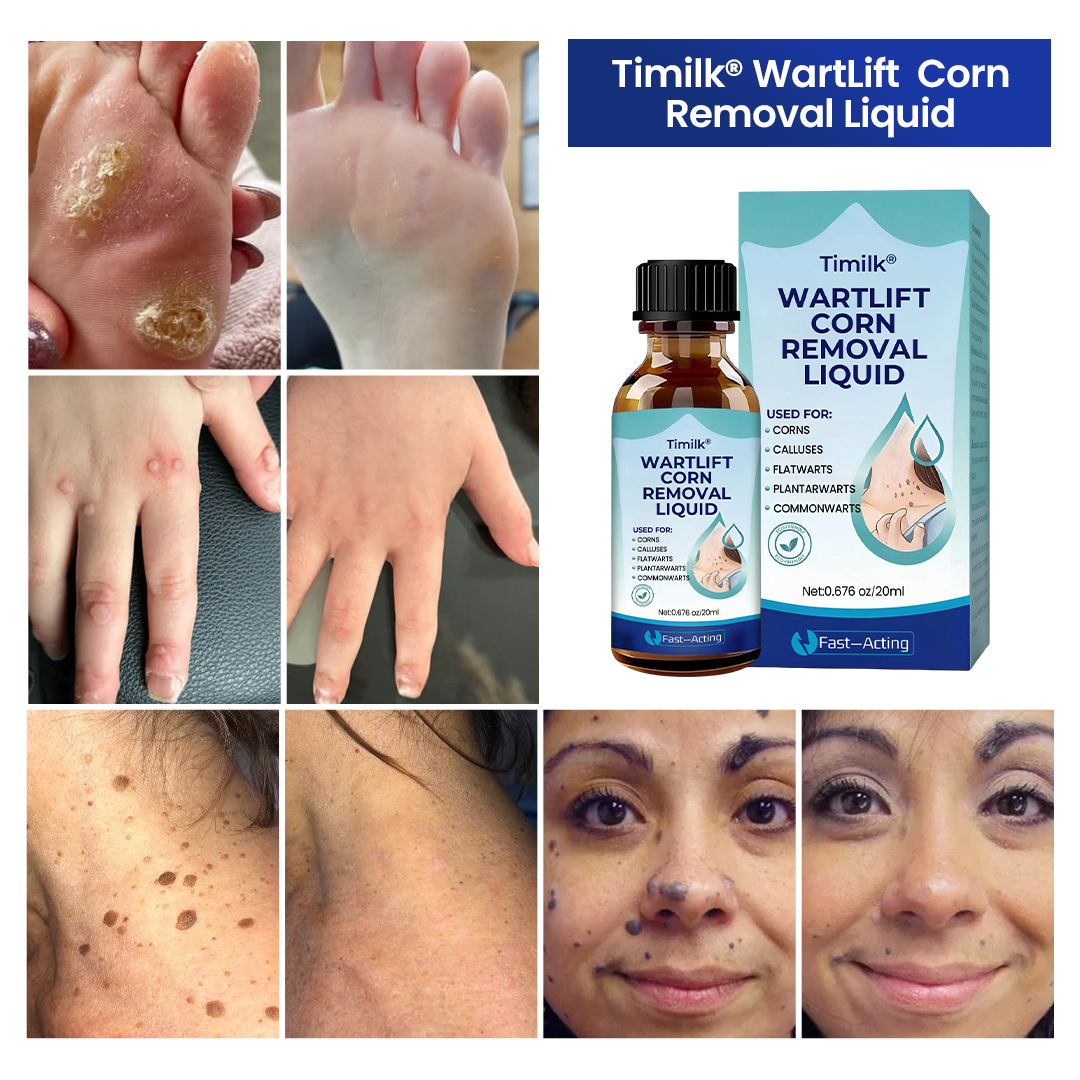 Timilk® WartLift Corn Removal Liquid ❤️