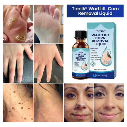 Timilk® WartLift Corn Removal Liquid ❤️
