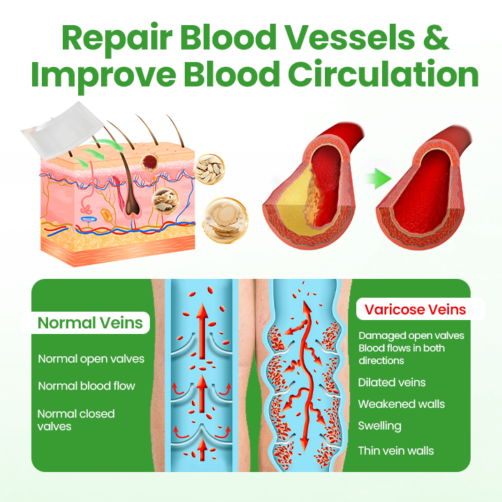 Healrize® VeinHeal Microneedle Patch ❤️