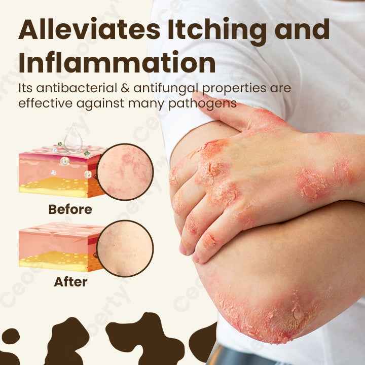 Ceoerty™ NatureCure Eczema Relief Serum❤️