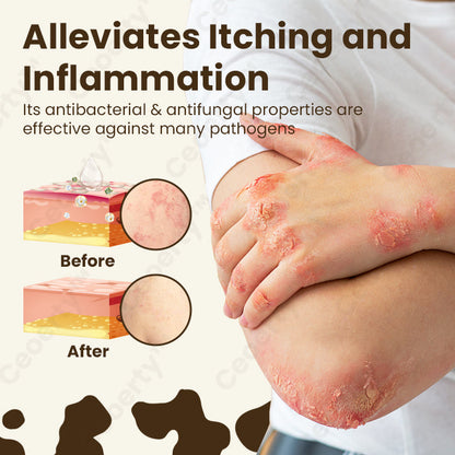 Ceoerty™ NatureCure Eczema Relief Serum❤️