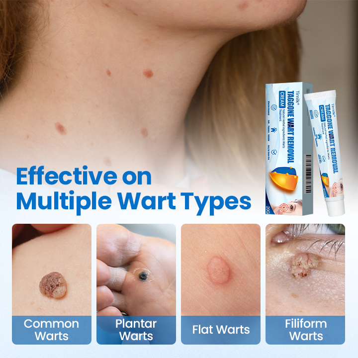 Timilk® TagGone Wart Removal Cream ❤️